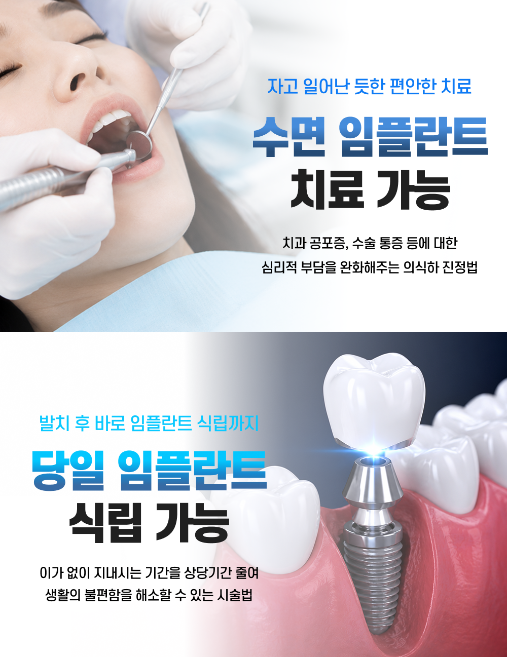 임플란트 차별점